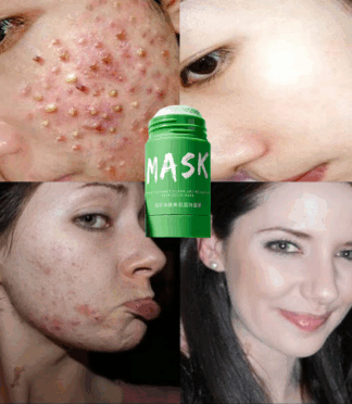 Green Tea Solid Mask Deep Cleansing Mask Moisturizing Mud Mask Acne Moisturizing Moisturizing Oil Control