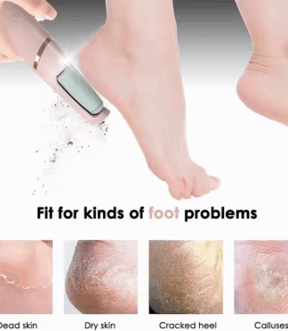 Pedicure Remove Dead Skin Electric Roller Foot File USB & Battery Powered Hand Held App-Controlled Callus Remover